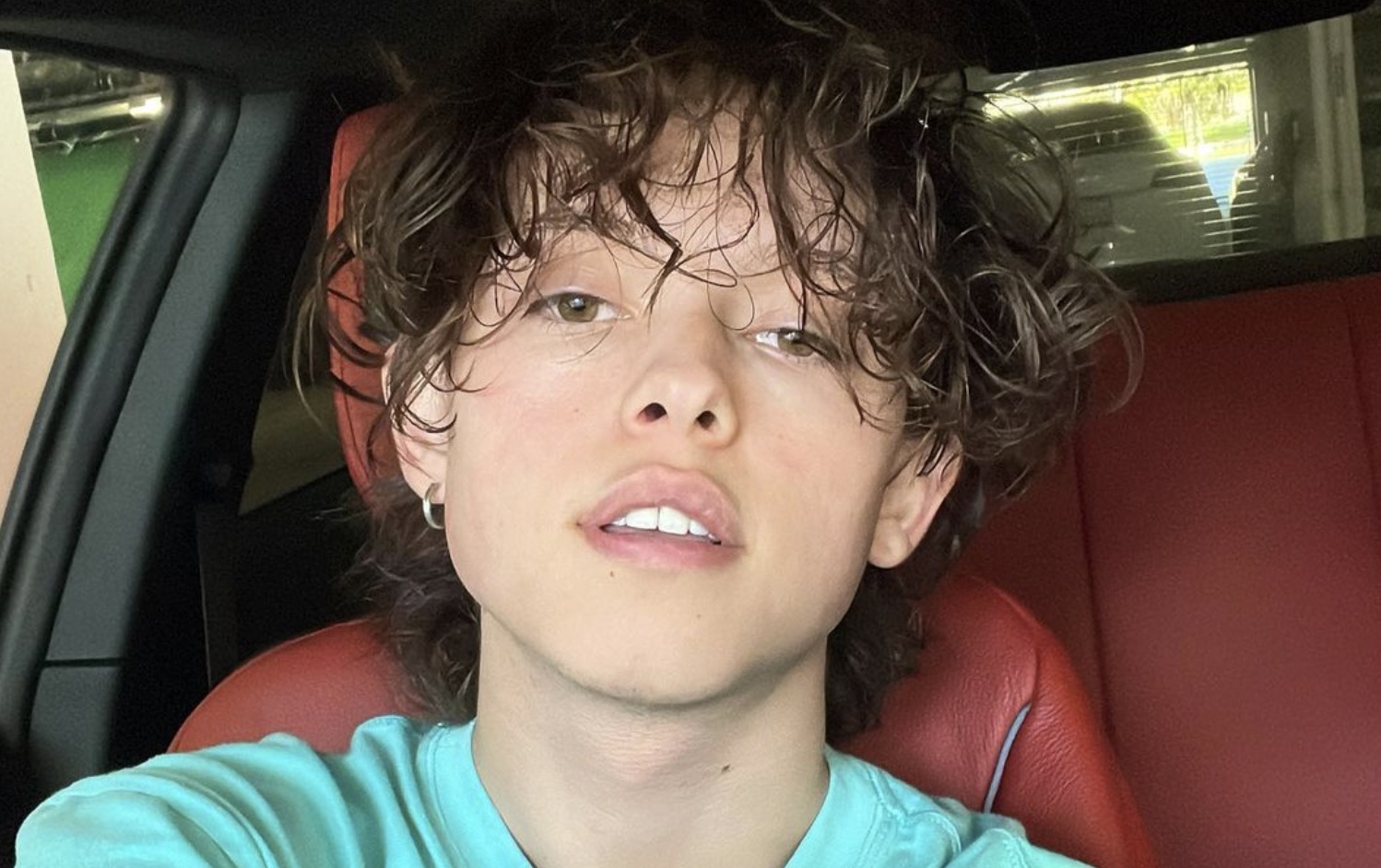 What Disease Does Jacob Sartorius Have? Is He Dead or Alive: What Happened To Him? Know Everything About Him